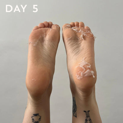 Maskology FOOT PEEL nulupamoji pėdų kaukė-kojinės, 1 pora