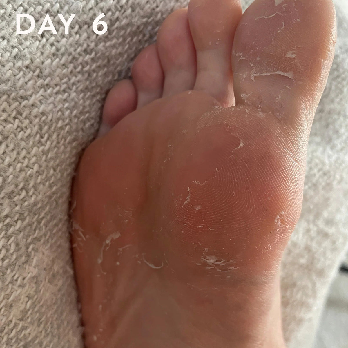 Maskology FOOT PEEL nulupamoji pėdų kaukė-kojinės, 1 pora